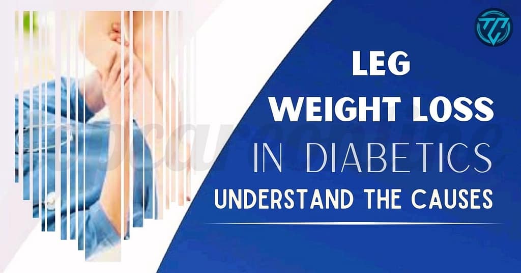 will diabetes cause weight loss, do diabetes cause weight loss, why does diabetes cause weight loss, why would diabetes cause weight loss, does diabetes cause weight loss or gain, will type 2 diabetes cause weight loss, does uncontrolled diabetes cause weight loss, does type 2 diabetes cause weight loss or gain, does gestational diabetes cause weight loss, can untreated diabetes cause weight loss, does pre diabetes cause weight loss, type 2 diabetes cause weight loss, does diabetes cause weight loss, lose weight diabetes type 1, how to lose weight as a diabetic, how to lose weight in diabetes, how to lose weight with diabetes, how do you lose weight with diabetes, how do i lose weight with diabetes, why would a diabetic lose weight, why do diabetes lose weight, why does diabetes lose weight, how to lose weight with diabetes type 1, how lose weight with diabetes type 2, why lose weight with diabetes, can you lose weight from diabetes, does losing weight help diabetes, can losing weight help diabetes, why do diabetic people lose weight, why do people lose weight with diabetes, does weight loss cure diabetes, can losing weight cure diabetes, will losing weight cure diabetes, do diabetics lose weight, why does diabetes cause you to lose weight, how does losing weight help diabetes, why does a type 1 diabetic lose weight, why does losing weight help diabetes, why do you lose weight when you have diabetes, why is it hard for diabetics to lose weight, can losing weight cause diabetes, why am i losing weight as a diabetic, why am i losing weight with diabetes, why do diabetics lose muscle mass, why do you lose weight with type 2 diabetes,