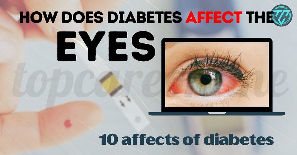 how does diabetes affect the eyes 10 affects of diabetes