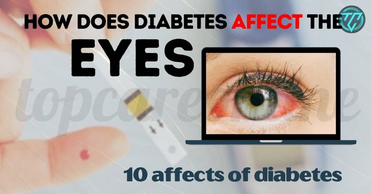 How does Diabetes Affect the Eyes: 10 Affects of Diabetes