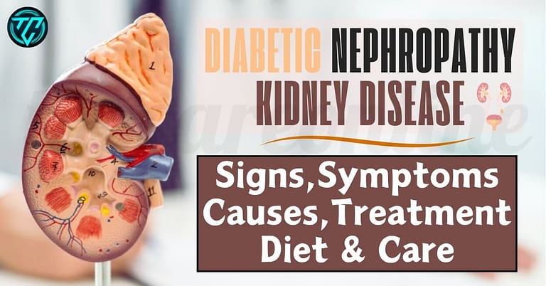 Diabetic Nephropathy Kidney Disease
