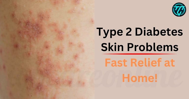 Type Two Diabetes Skin Problems Fast Relief at Home!
